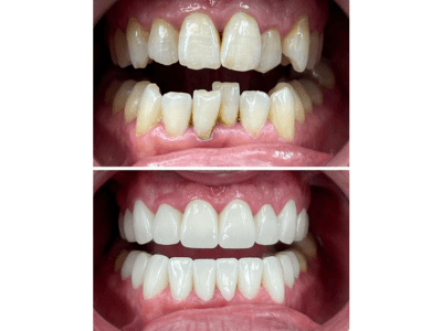 Best Smile Design Specialist Doctor in Adilabad-Best Dental Clinic in Adilabad